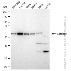 KD-Validated CAT Rabbit mAb (20 μl)