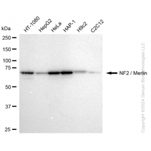 KD-Validated NF2 Rabbit mAb (20 μl)