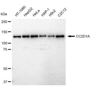 KD-Validated CC2D1A Rabbit mAb (20 μl)