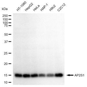 KD-Validated AP2S1 Rabbit mAb (20 μl)