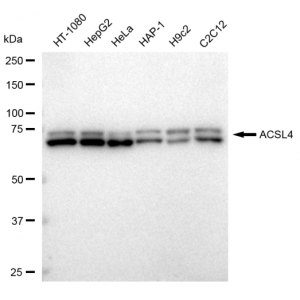 KD-Validated ACSL4 Rabbit mAb (20 μl)