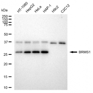 KD-Validated BRMS1 Rabbit mAb (20 μl)