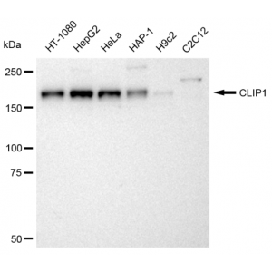 KD-Validated CLIP1 Rabbit mAb (20 μl)