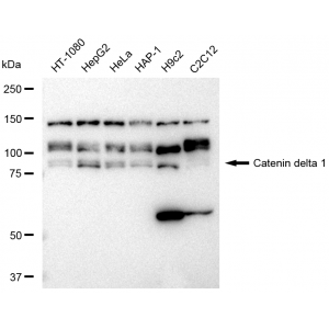 KD-Validated CTNND1 Rabbit mAb (20 μl)