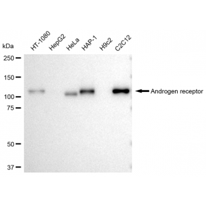 KD-Validated AR Rabbit mAb (20 μl)