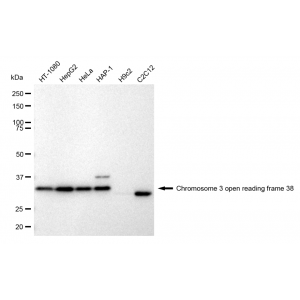 KD-Validated C3orf38 Rabbit mAb (20 μl)