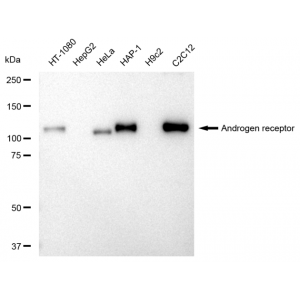 KD-Validated AR Rabbit mAb (20 μl)