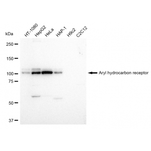 KD-Validated AHR Rabbit mAb (20 μl)