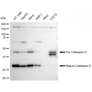KD-Validated CTSD Rabbit mAb (20 μl)