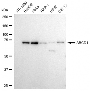 KD-Validated ABCD1 Rabbit mAb (20 μl)