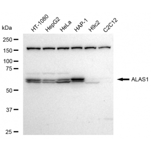 KD-Validated ALAS1 Rabbit mAb (20 μl)