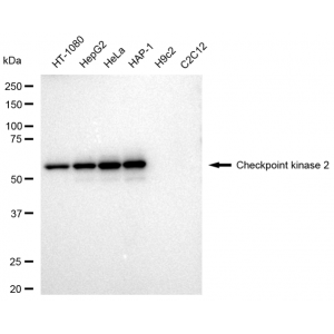 KD-Validated CHEK2 Rabbit mAb (20 μl)