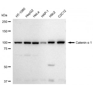 KD-Validated CTNNA1 Rabbit mAb (20 μl)
