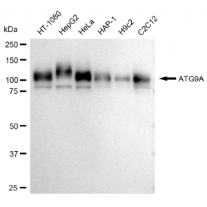 KD-Validated ATG9A Rabbit mAb (20 μl)