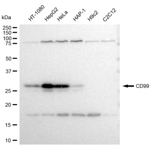 KD-Validated CD99 Rabbit mAb (20 μl)