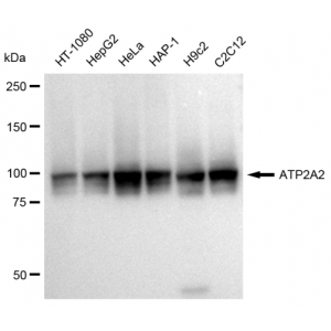 KD-Validated ATP2A2 Rabbit mAb (20 μl)