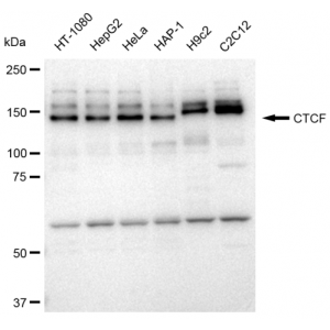 KD-Validated CTCF Rabbit mAb (20 μl)