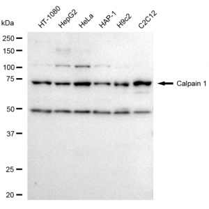 KD-Validated CAPN1 Rabbit mAb (20 μl)