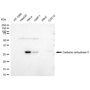 KD-Validated CA2 Rabbit mAb (20 μl)