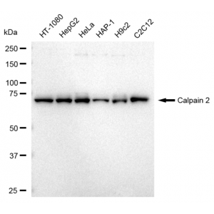 KD-Validated CAPN2 Rabbit mAb (20 μl)
