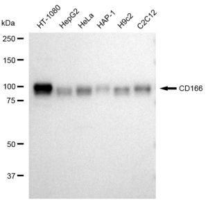 KD-Validated CD166 Rabbit mAb (20 μl)