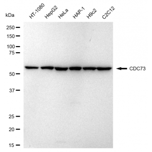 KD-Validated CDC73 Rabbit mAb (20 μl)