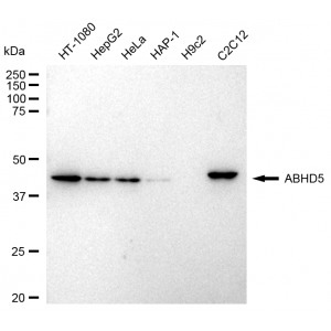 KD-Validated ABHD5 Rabbit mAb (20 μl)