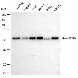 KD-Validated CBX2 Rabbit mAb (20 μl)