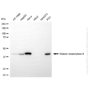 KD-Validated HDAC8 Rabbit mAb (20 μl)