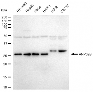 KD-Validated ANP32B Rabbit mAb (20 μl)