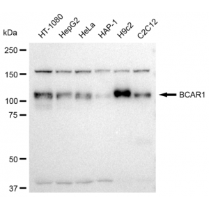 KD-Validated BCAR1 Rabbit mAb (20 μl)