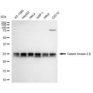 KD-Validated CSNK2B Rabbit mAb (20 μl)