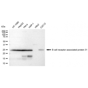 KD-Validated BCAP31 Rabbit mAb (20 μl)