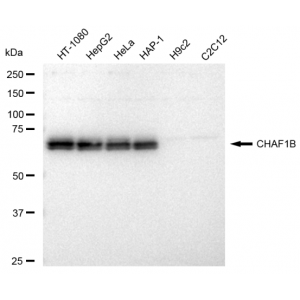 KD-Validated CHAF1B Rabbit mAb (20 μl)