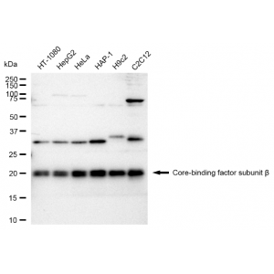 KD-Validated CBFB Rabbit mAb (20 μl)