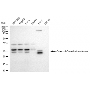 KD-Validated COMT Rabbit mAb (20 μl)