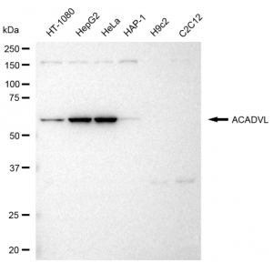 KD-Validated ACADVL Rabbit mAb (20 μl)