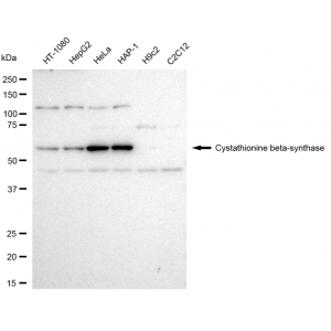 KD-Validated CBS Rabbit mAb (20 μl)