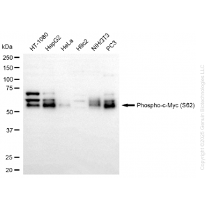 KD-Validated Phospho-MYC (S62) Rabbit mAb (20 μl)