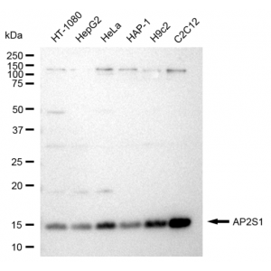 KD-Validated AP2S1 Rabbit mAb (20 μl)