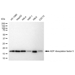KD-Validated ARF5 Rabbit mAb (20 μl)