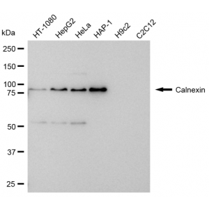 KD-Validated CANX Rabbit mAb (20 μl)