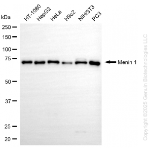 KD-Validated MEN1 Rabbit mAb (20 μl)