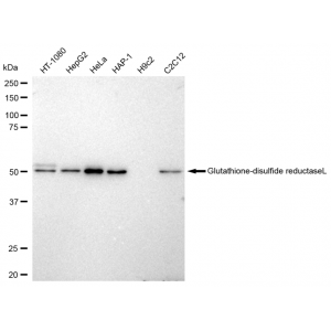 KD-Validated GSR Rabbit mAb (20 μl)