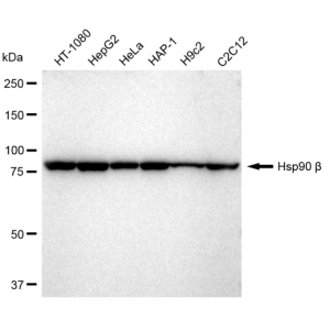 KD-Validated Hsp90 beta Rabbit mAb (20 μl)