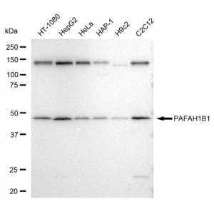 KD-Validated PAFAH1B1 Rabbit mAb (20 μl)