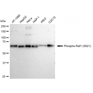 KD-Validated Phospho-Raf1 (S621) Rabbit mAb (20 μl)