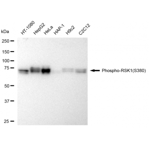 KD-Validated Phospho-RSK1 (S380) Rabbit mAb (20 μl)