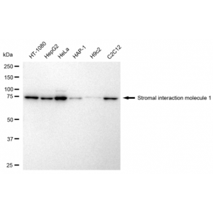 KD-Validated STIM1 Rabbit mAb (20 μl)