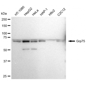 KD-Validated Grp75 Rabbit mAb (20 μl)